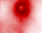 arzt kosten overlapped io operation progress